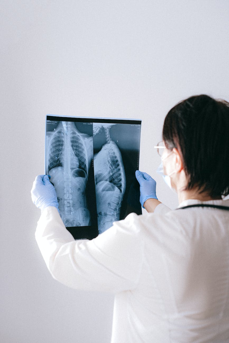 a doctor holding an x ray result