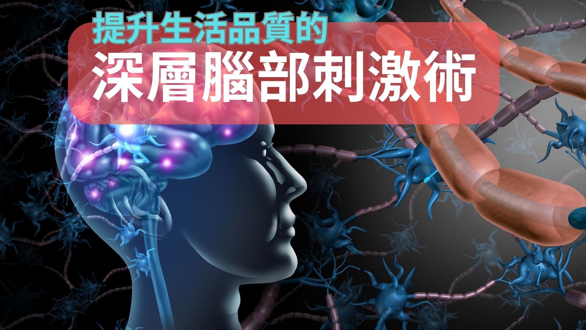 DBS 深層腦部刺激術
可以改善生活品質
帕金森病人的福音